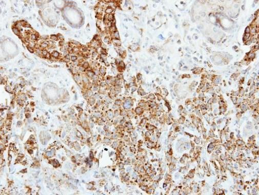 Pancreatic Lipase Rabbit Polyclonal Antibody