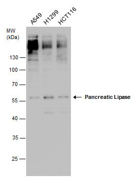 Pancreatic Lipase Rabbit Polyclonal Antibody