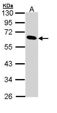 Pancreatic Lipase Rabbit Polyclonal Antibody