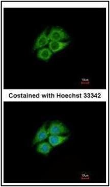 PANK1 Rabbit Polyclonal Antibody
