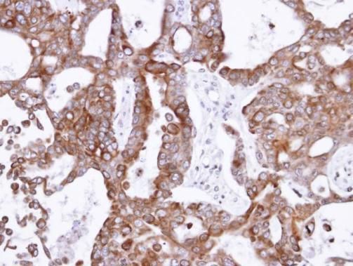 PANK1 Rabbit Polyclonal Antibody