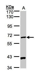 PANK1 Rabbit Polyclonal Antibody
