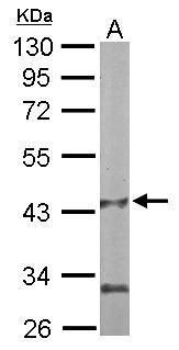 PANK1 Rabbit Polyclonal Antibody