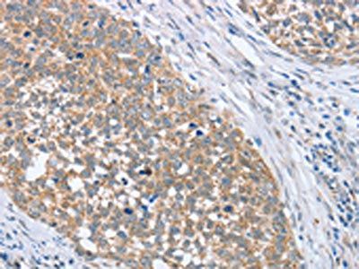 PAPSS1 Antibody