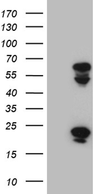 PAPSS2 Antibody