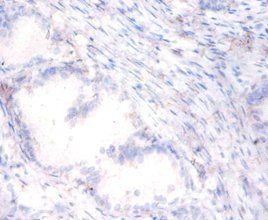PON1 Antibody