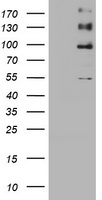 Parathyroid hormone related protein Antibody