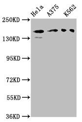 PARD3 Antibody