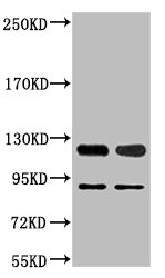 PARP1 Antibody
