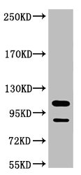 PARP1 Antibody
