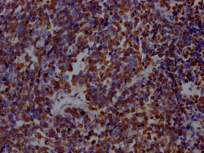PARP1 Antibody