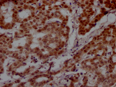 PARP1 Antibody