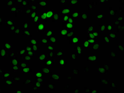 PARP1 Antibody