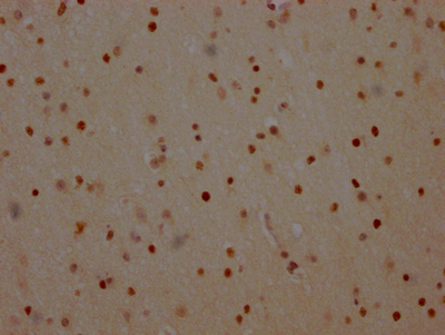 PARP1 Antibody