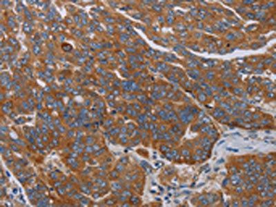 PARP10 Antibody