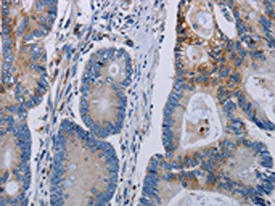PARP10 Antibody