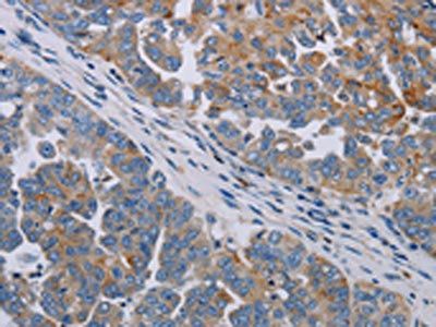 PARP10 Antibody