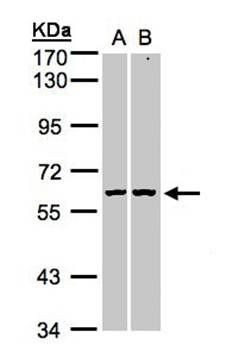 PARP3 Rabbit Polyclonal Antibody