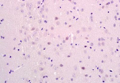 PATZ1 Rabbit Polyclonal Antibody