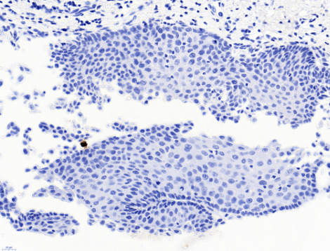 PAX3 Antibody