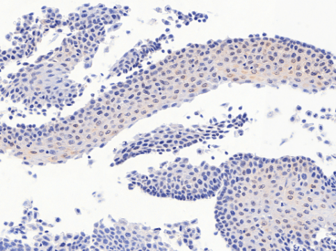 PAX3 Antibody