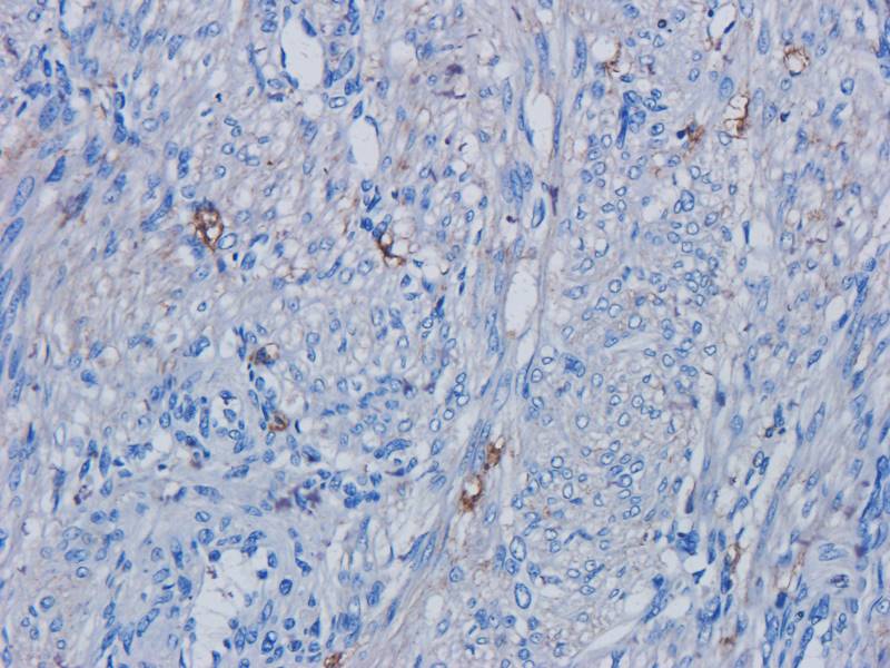 PAX6 Rabbit Polyclonal Antibody