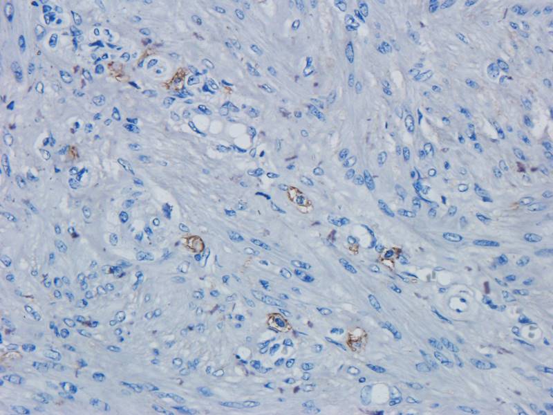 PAX6 Rabbit Polyclonal Antibody