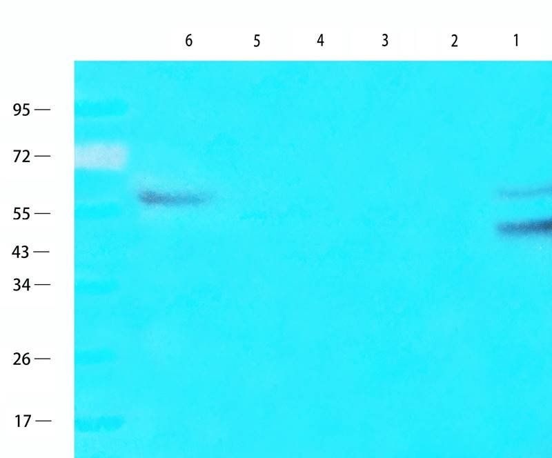 PAX6 Rabbit Polyclonal Antibody