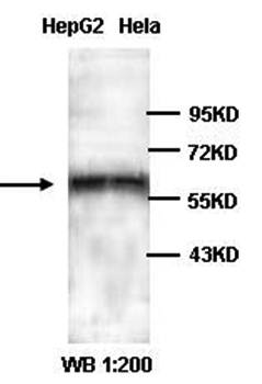 PBX3 Rabbit Polyclonal Antibody