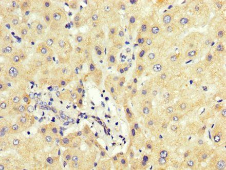 PCBP2 Antibody