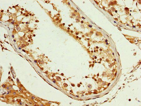 PCBP2 Antibody