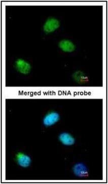 PCBP2 Rabbit Polyclonal Antibody