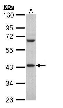 PCBP2 Rabbit Polyclonal Antibody