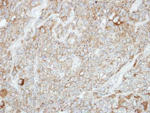PCDH1 Rabbit Polyclonal Antibody