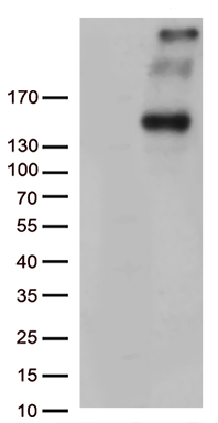 PCDH15 Antibody