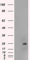 PCDH15 Antibody