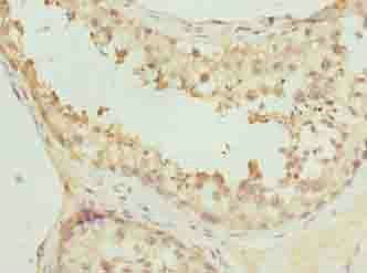 PCED1A Antibody