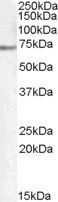 PCK2/PEPCK-M Antibody