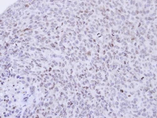 PCNP Rabbit Polyclonal Antibody