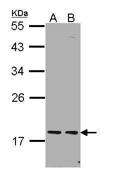 PCNP Rabbit Polyclonal Antibody