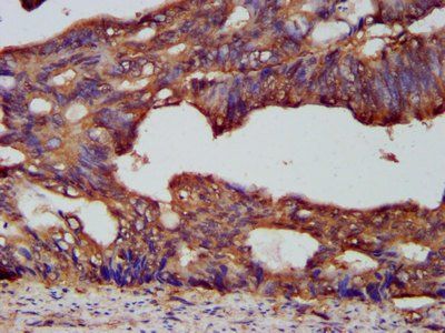 PCSK7 Antibody