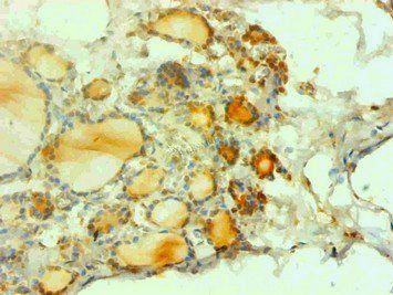 CALCA Antibody