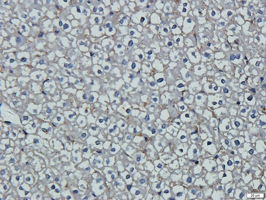 PD2R2 antibody