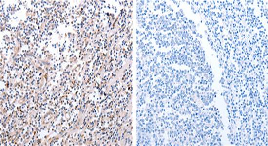 PDCD10 Antibody