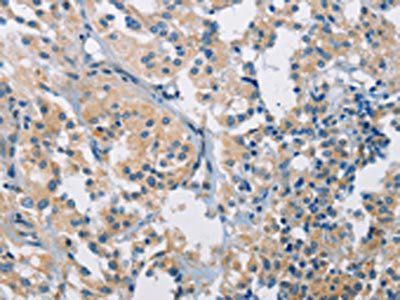 PDCD1LG2 Antibody