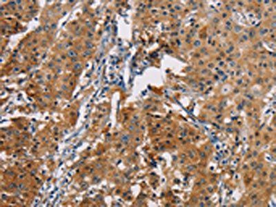 PDCD1LG2 Antibody