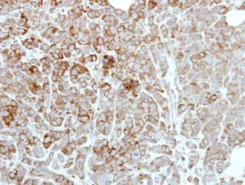 PDE1A Rabbit Polyclonal Antibody