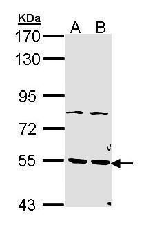 PDE1A Rabbit Polyclonal Antibody