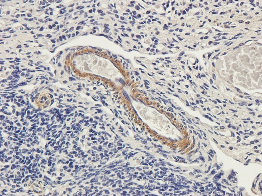 PDE1C Rabbit Polyclonal Antibody