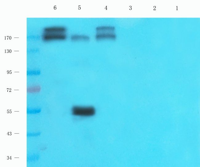 PDE1C Rabbit Polyclonal Antibody